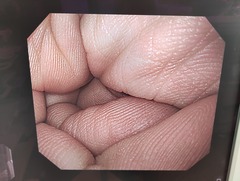 上部消化管汎用ビデオスコープ｜GIF-H260｜オリンパスメディカルシステムズ株式会社の写真10枚目