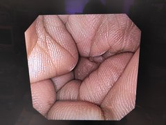 上部消化管経鼻スコープ｜GIF-XP170N｜オリンパスメディカルシステムズ株式会社の写真10枚目