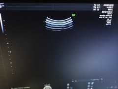 4D超音波診断装置（カラードプラ）｜Voluson E10｜GEヘルスケアの写真10枚目