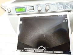 超音波診断装置｜F37｜日立製作所の写真10枚目