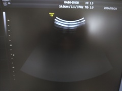 4D超音波診断装置（カラードプラ）｜Voluson E6｜GEヘルスケアの写真10枚目