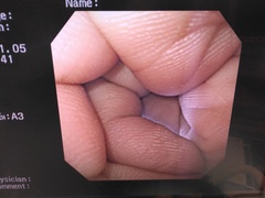上部消化管汎用ビデオスコープ｜GIF-XQ240｜オリンパスメディカルシステムズ株式会社の写真10枚目