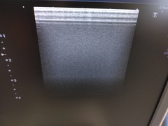 超音波診断装置（カラードプラ）｜Xario100 TUS-X100｜キヤノンメディカルシステムズの写真10枚目
