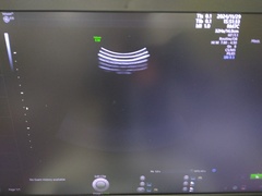 4D超音波診断装置（カラードプラ）｜Voluson E10｜GEヘルスケアの写真10枚目