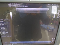 Ultrasound system(Color)｜LOGIQ P5｜GE Healthcare photo10