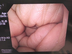 上部消化管汎用ビデオスコープ｜GIF-H260｜オリンパスメディカルシステムズ株式会社の写真10枚目
