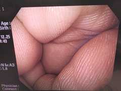 Video Gastroscope｜GIF-Q240X｜Olympus Medical Systems photo10