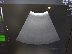 4D超音波診断装置（カラードプラ）｜Voluson P8｜GEヘルスケアの写真10枚目