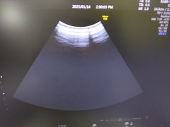 超音波診断装置｜Voluson S10｜GEヘルスケアの写真10枚目
