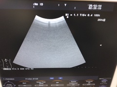 超音波診断装置｜F31｜日立製作所の写真10枚目