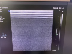 超音波診断装置｜Affiniti 50G｜フィリップスの写真10枚目