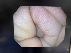 Video Gastroscope｜GIF-H190N｜Olympus Medical Systems photo10