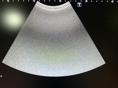 ｜Aplio 400 TUS-A400｜Canon Medical Systems photo10