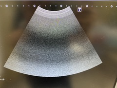 Ultrasound System(Color)｜Xario100 TUS-X100｜Canon Medical Systems photo10