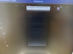 超音波診断装置（カラードプラ）｜XARIO 200 TUS‐X200｜キヤノンメディカルシステムズの写真10枚目