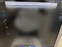 超音波診断装置（カラードプラ）｜Xario100 TUS-X100S｜キヤノンメディカルシステムズの写真10枚目
