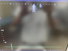 Ultrasound System(Color)｜Xario100 TUS-X100｜Canon Medical Systems photo10