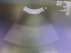 Ultrasound system(Color)｜Voluson E10｜GE Healthcare photo10