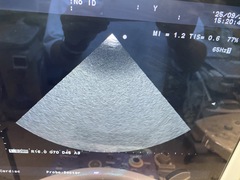 Ultrasound system(Color)｜Prosound α6｜Hitachi photo10