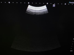 UltrasoundSystem｜Aplio a  Verifia/CUS-AA000｜Canon Medical Systems photo10