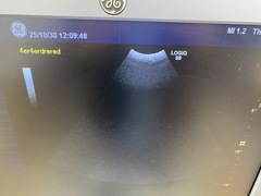 超音波診断装置｜LOGIQ S8｜GEヘルスケアの写真10枚目