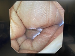 Video Gastroscope｜GIF-XQ260｜Olympus Medical Systems photo10