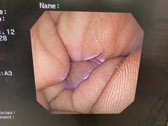 Video Gastroscope｜GIF-XP260NS｜Olympus Medical Systems photo10