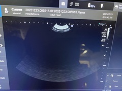 Ultrasound System(Color)｜Viamo SV7   CUS-VSV7｜Canon Medical Systems photo10