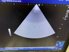 超音波診断装置｜LOGIQ e Premium｜GEヘルスケアの写真10枚目