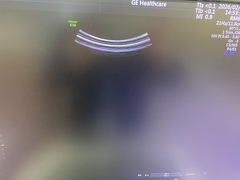 Ultrasound system(Color)｜Voluson E10｜GE Healthcare photo10