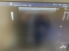 Ultrasound system(Color)｜LOGIQ P9｜GE Healthcare photo10