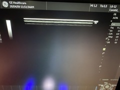 Ultrasound system(Color)｜LOGIQ P9 Pro｜GE Healthcare photo10