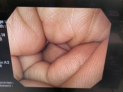 Video Gastroscope｜GIF-Q260｜Olympus Medical Systems photo10