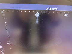 Ultrasound system(Color)｜SSA-580A Nemio XG｜Canon Medical Systems photo10