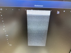 超音波診断装置（カラードプラ）｜XARIO 200 TUS‐X200｜キヤノンメディカルシステムズの写真10枚目