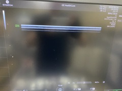 Ultrasound system｜Voluson Expert 22｜GE Healthcare photo10