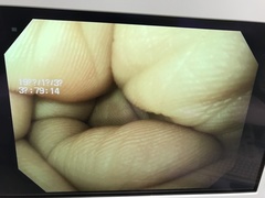 Video Gastroscope｜GIF-V70｜Olympus Medical Systems photo11