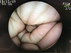 Video Gastroscope｜EG-200FP TYPE S｜Fujifilm Medical photo11