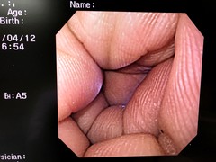 Video Gastroscope｜GIF-SV｜Olympus Medical Systems photo8