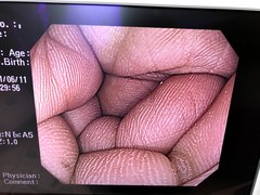 Video Gastroscope｜GIF-H260Z｜Olympus Medical Systems photo6