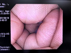 Video Gastroscope｜GIF-H260Z｜Olympus Medical Systems photo6