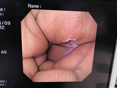 Video Gastroscope｜GIF-XQ240｜Olympus Medical Systems photo11