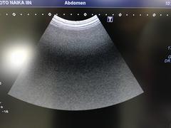 超音波診断装置（カラードプラ）｜Xario 100G  CUS-X100G｜キヤノンメディカルシステムズの写真11枚目