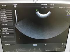４Ｄ超音波診断装置（カラードプラ）｜Voluson e｜GEヘルスケアの写真11枚目