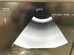 超音波診断装置（カラードプラ）｜ARIETTA 70｜日立製作所の写真11枚目