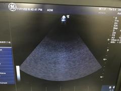 超音波診断装置（カラードプラ）｜LOGIQ e Expert｜GEヘルスケアの写真11枚目