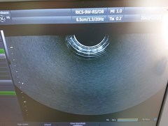Ultrasound system(Color)｜Voluson P8｜GE Healthcare photo11