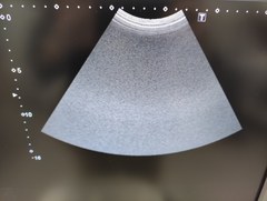 超音波診断装置（カラードプラ）｜Xario100 TUS-X100S｜キヤノンメディカルシステムズの写真11枚目