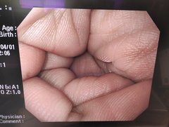 上部消化管汎用ビデオスコープ｜GIF-Q260｜オリンパスメディカルシステムズ株式会社の写真11枚目
