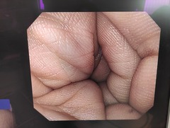 上部消化管汎用ビデオスコープ｜GIF-H290Z｜オリンパスメディカルシステムズ株式会社の写真11枚目